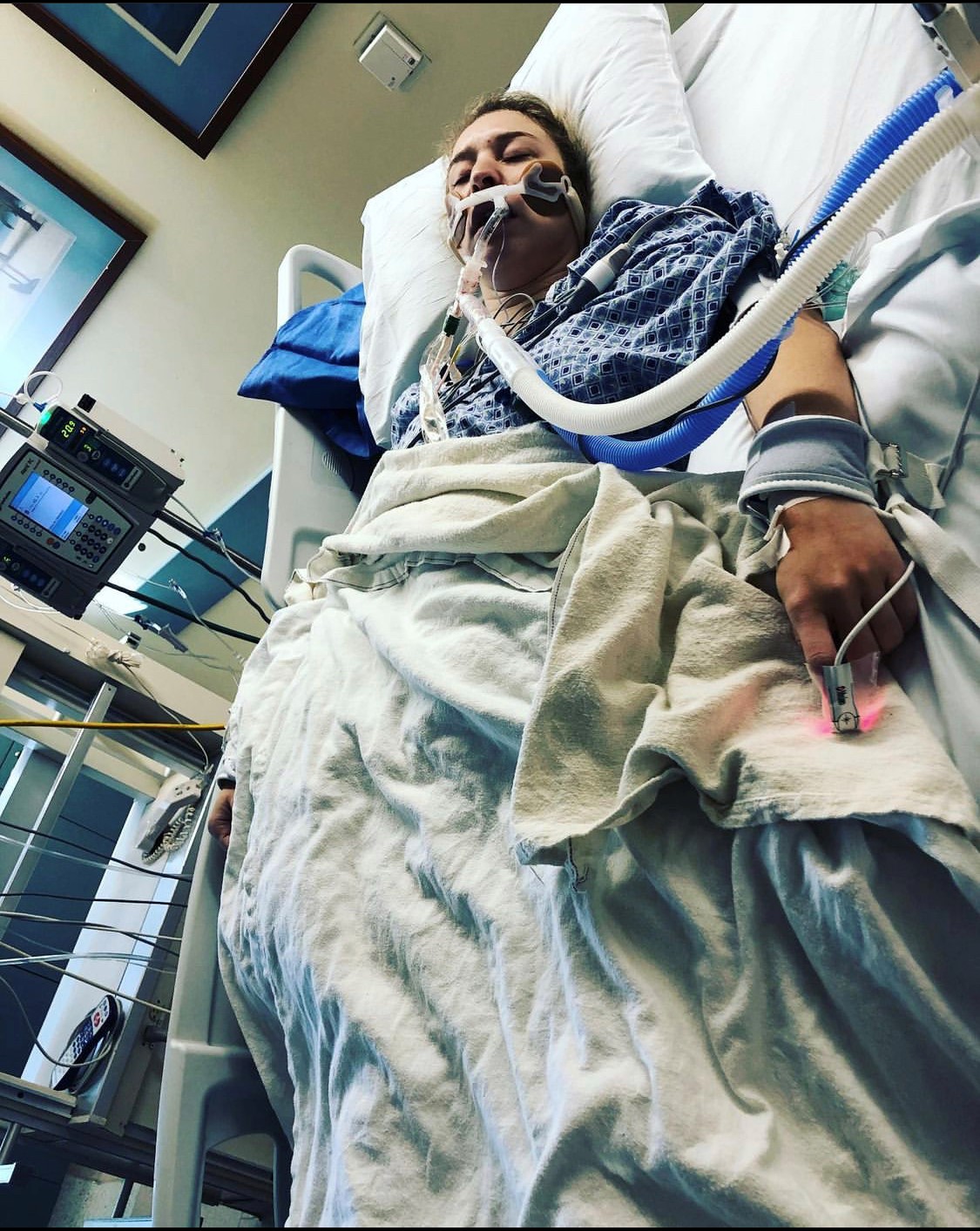 Sarah Fuller lies on a hospital bed following a procedure. Tubes are hooked up to her.